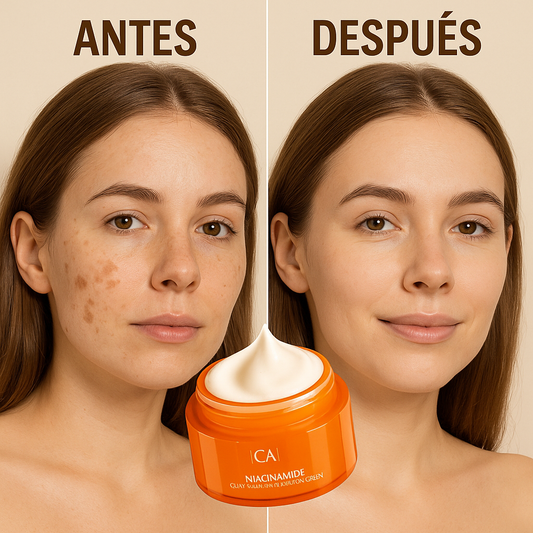 ✨ La Crema ANTI MANCHAS ETAE #1 Aclara, Hidrata y Rejuvenece